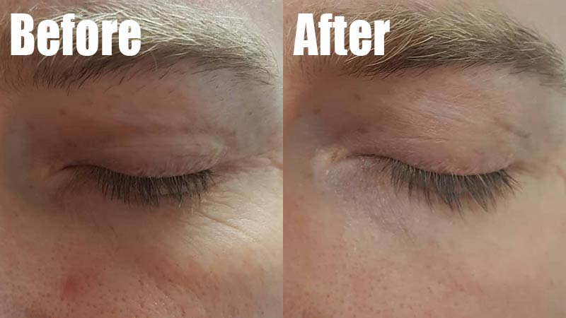 before and after photos of face where sea moss gel has resulted in healthier looking skin with a focus on the closeup around the eyes